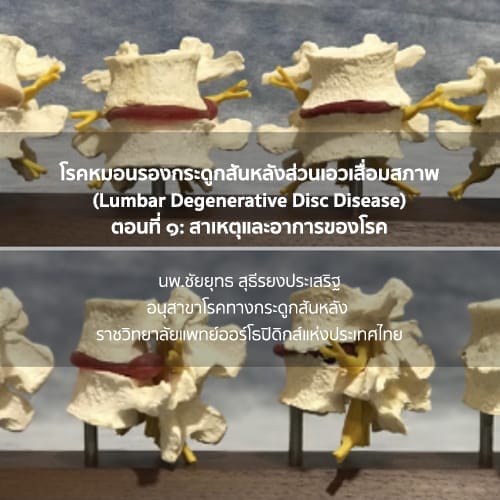 กระดูกสันหลัง ภาพจำลองกระดูกสันหลังส่วนเอวเสื่อมสภาพ, โรคหมอนรองกระดูกสันหลังส่วนเอวเสื่อมสภาพ ออร์โธปิดิกส์
