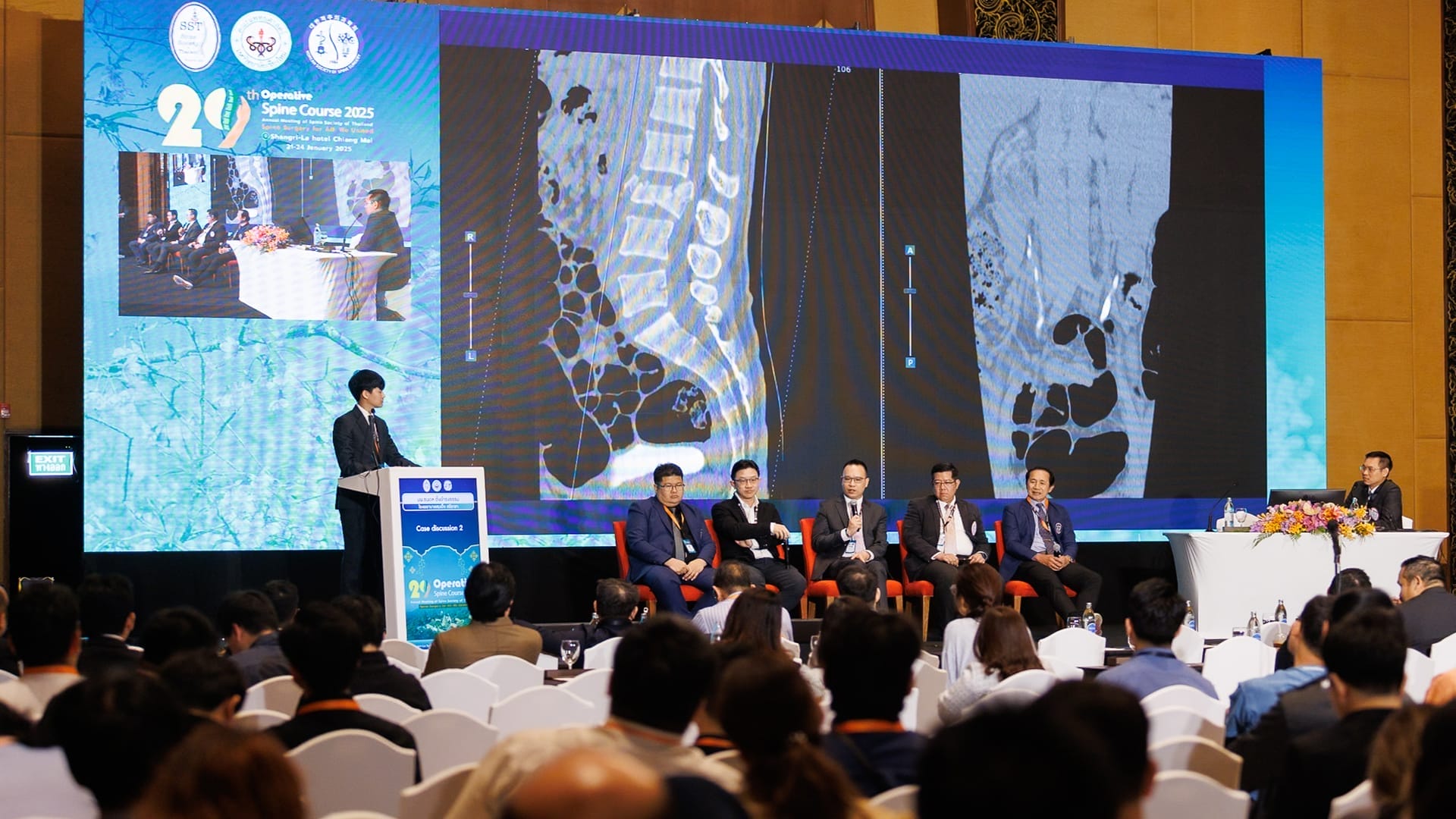 Basic Spine Course 2025 conference, panel discussion and medical imaging presentation on stage