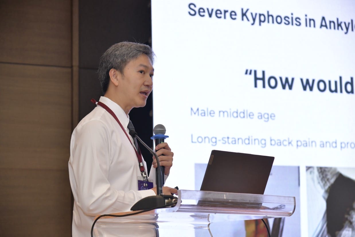 กระดูกสันหลัง วิทยากรบรรยายเรื่องกระดูกสันหลังคดในการประชุมวิชาการ BASIC SPINE COURSE 2025 ออร์โธปิดิกส์