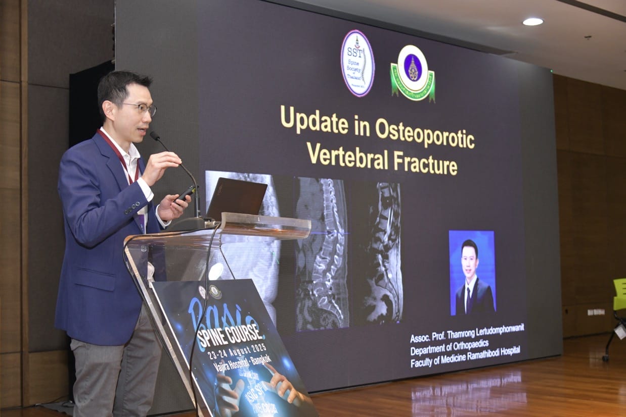 กระดูกสันหลัง วิทยากรบรรยายเรื่องกระดูกสันหลังพรุนแตก ในงานประชุมวิชาการ BASIC SPINE COURSE 2025 ออร์โธปิดิกส์